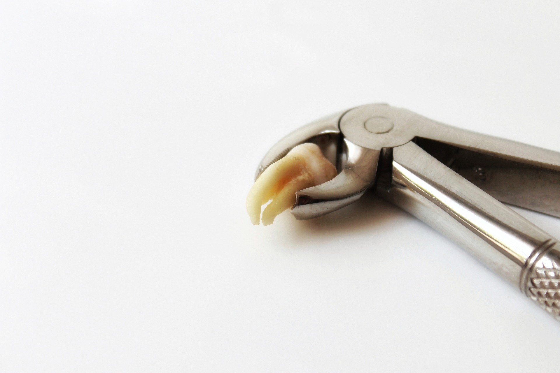 Tooth Extractions: Everything You Need to Know